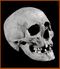 Romano-Brithish skull at Richborough (M0014563).jpg